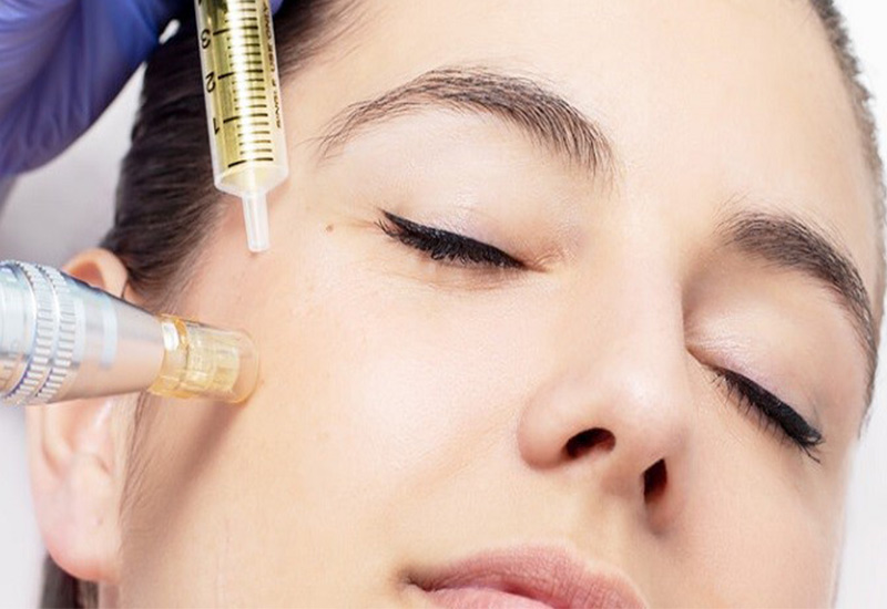 جوانسازی پوست با مزوتراپی