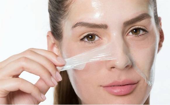 لایه برداری در زمستان