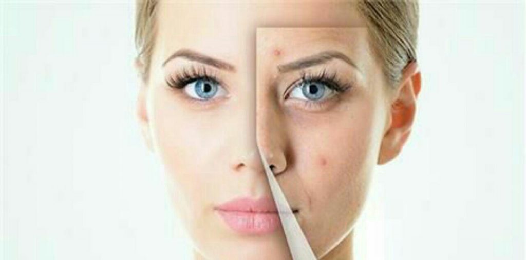 مراقبت های پس از پاکسازی: