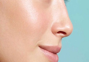 معضلات پوست چرب