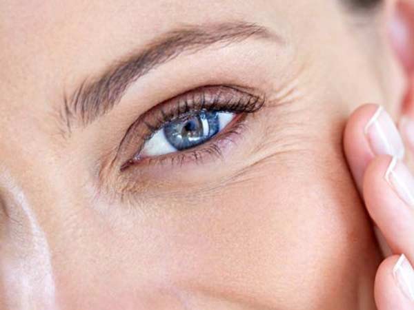 درمان خانگی برای از بین بردن چین و چروک دور چشم