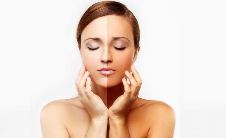 شفاف سازی پوست