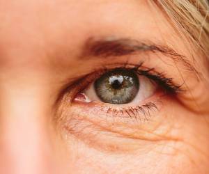 میکرونیدلینگ