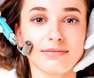 میکرونیدلینگ