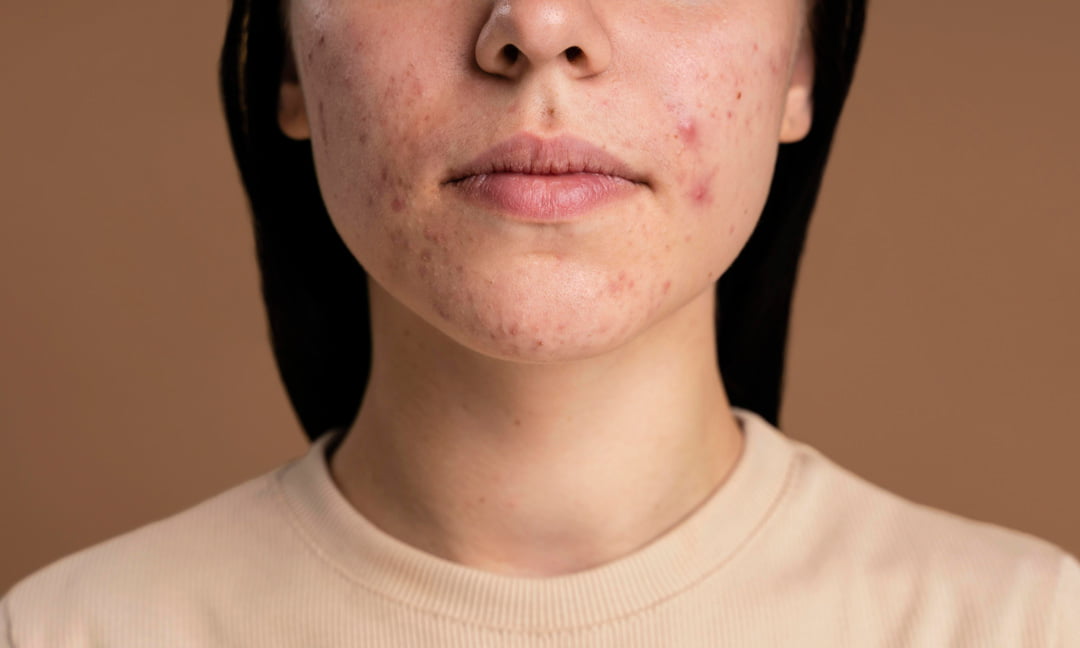 روش های مراقبت از پوست خانگی که نباید انجام دهید