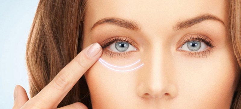 درمان تیرگی زیر چشم