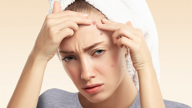 دلایل ایجاد جوش ‌ها