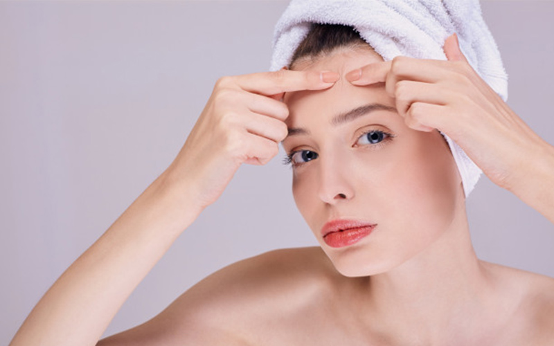 چگونه از بروز آکنه پیشگیری کنیم؟ 