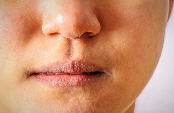 علت خشکی لب