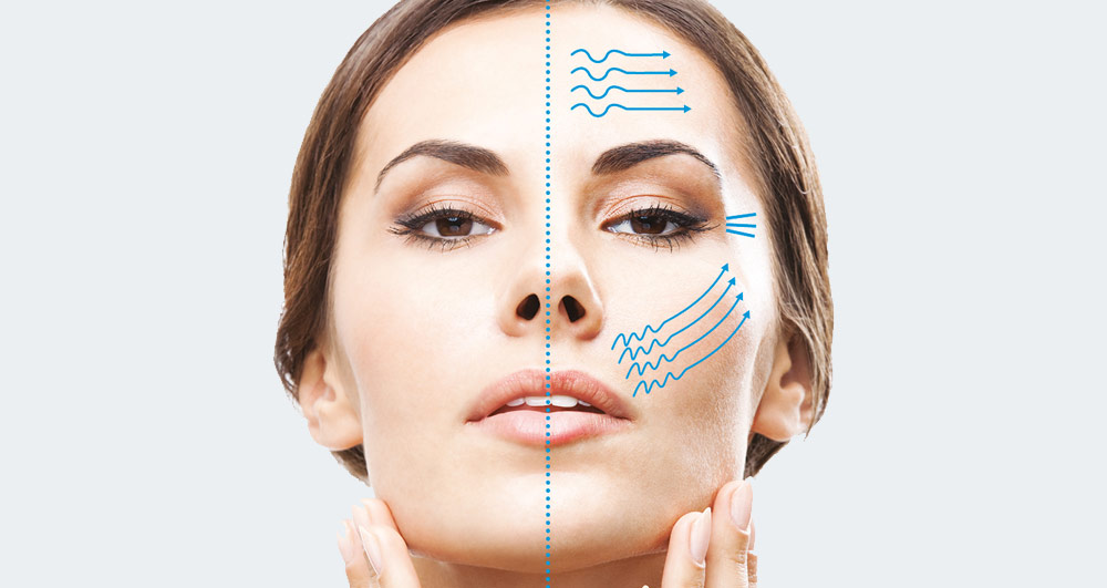 مزایای انجام هایفوتراپی