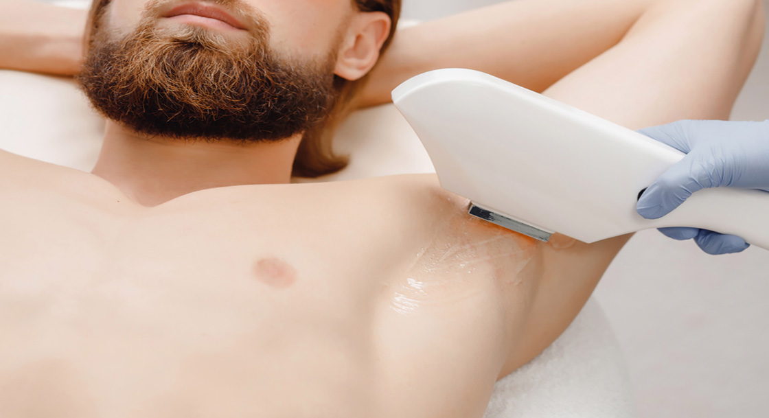 فاصله بین هر مرحله حذف موهای زائد زیر بغل چقدر است؟