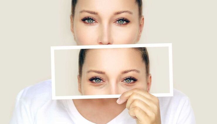 هزینه پلکسر پلک چقدر است؟