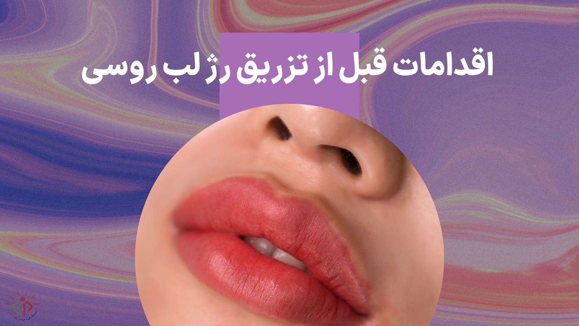 اقدامات قبل از تزریق رژ لب روسی