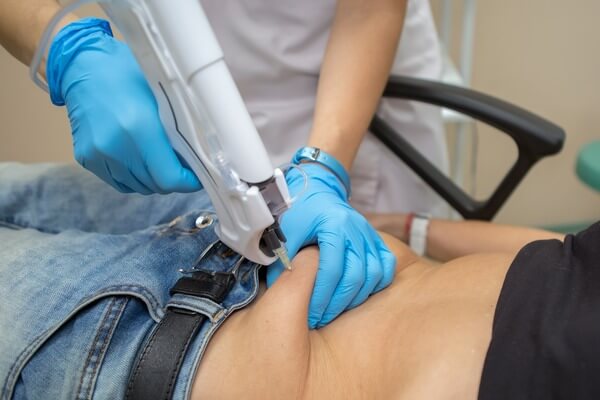 کربوکسی تراپی با دستگاه BmedGroup 