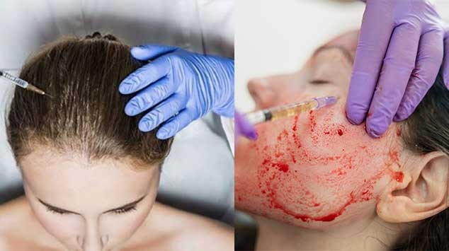 دستگاه سانتریفیوژ 16 حالته